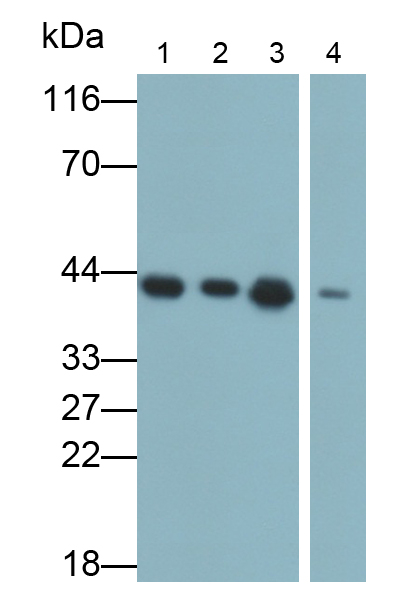 Polyclonal Antibody to Creatine Kinase B (CK-BB)