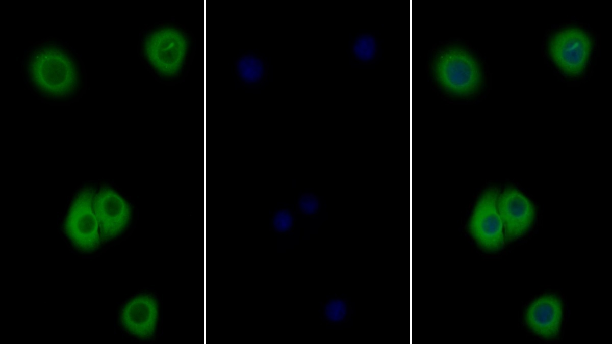 Polyclonal Antibody to Interleukin 4 Receptor (IL4R)