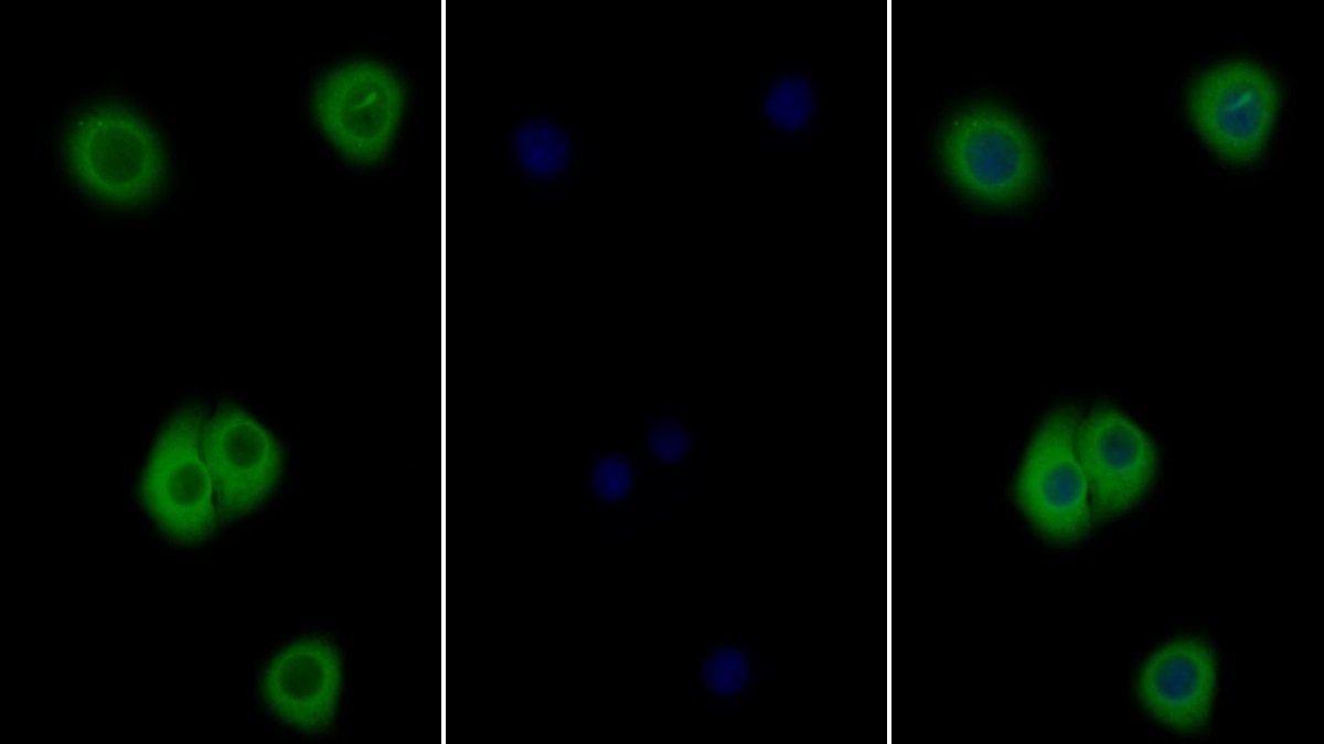 Polyclonal Antibody to Interleukin 4 Receptor (IL4R)