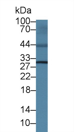 Polyclonal Antibody to Interleukin 4 Receptor (IL4R)