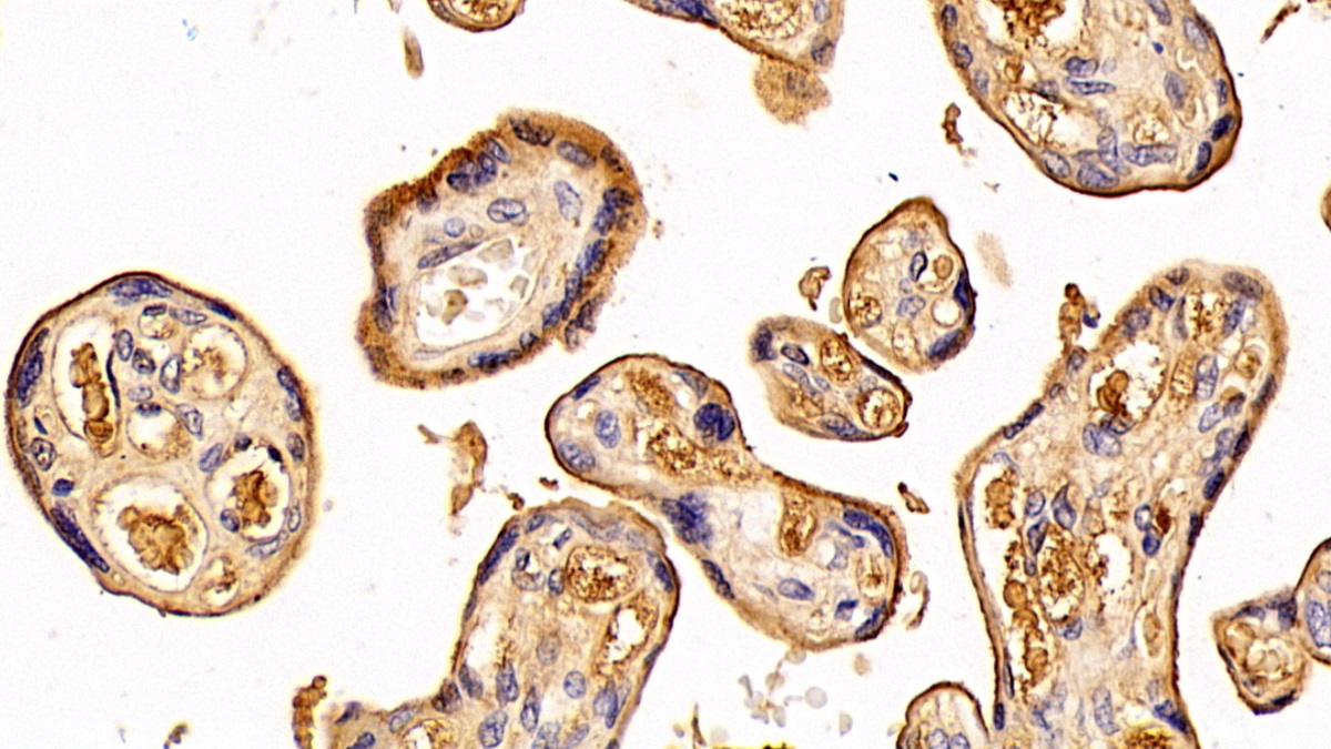 Polyclonal Antibody to Transferrin (TF)