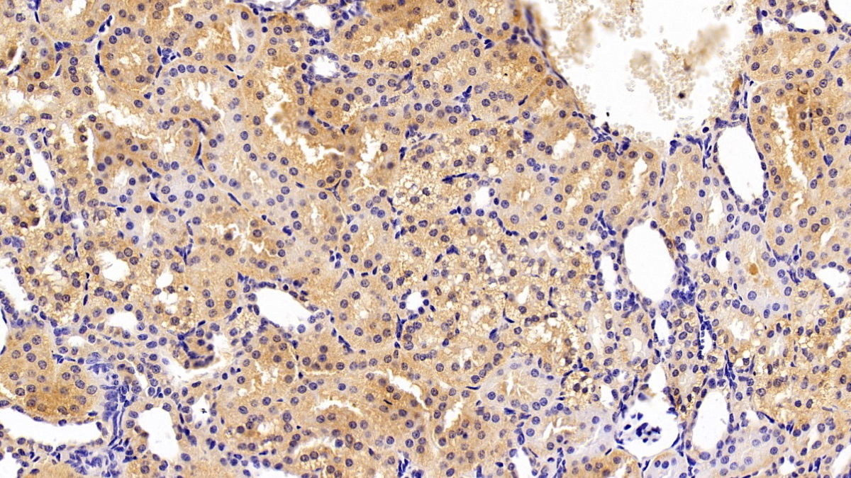 Polyclonal Antibody to Transferrin (TF)