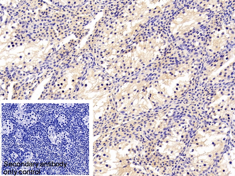 Polyclonal Antibody to Transferrin (TF)