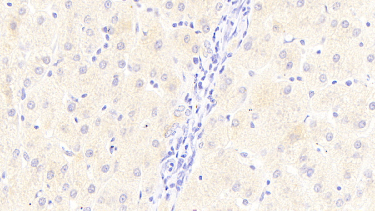 Polyclonal Antibody to Transferrin (TF)