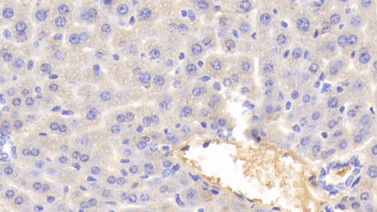 Polyclonal Antibody to Transferrin (TF)