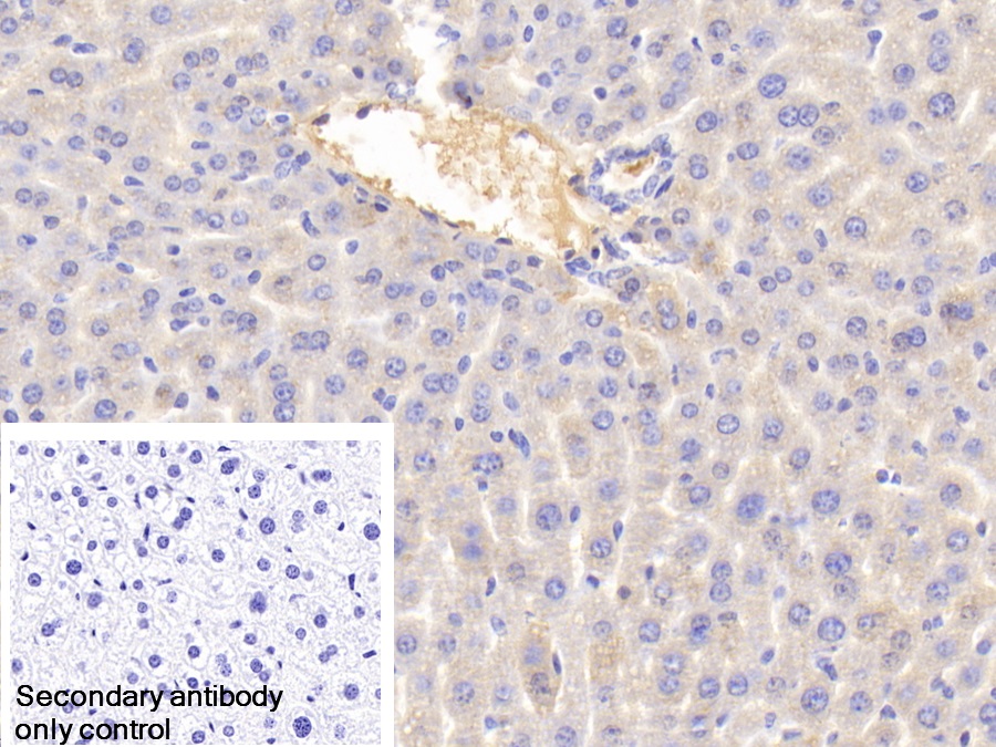 Polyclonal Antibody to Transferrin (TF)