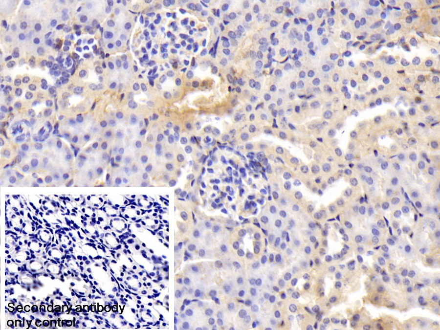 Polyclonal Antibody to Transferrin (TF)