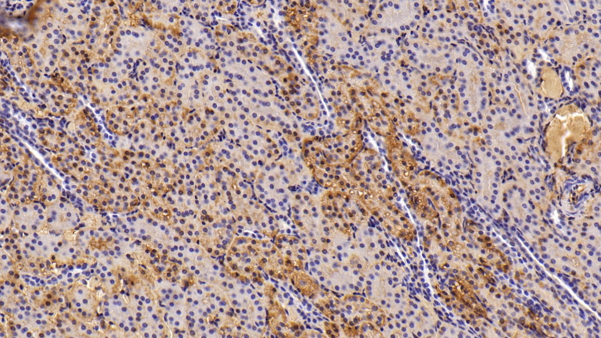 Polyclonal Antibody to Transferrin (TF)