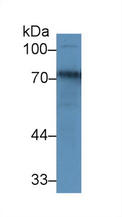 Polyclonal Antibody to Transferrin (TF)