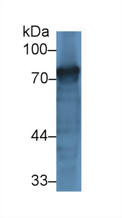 Polyclonal Antibody to Transferrin (TF)