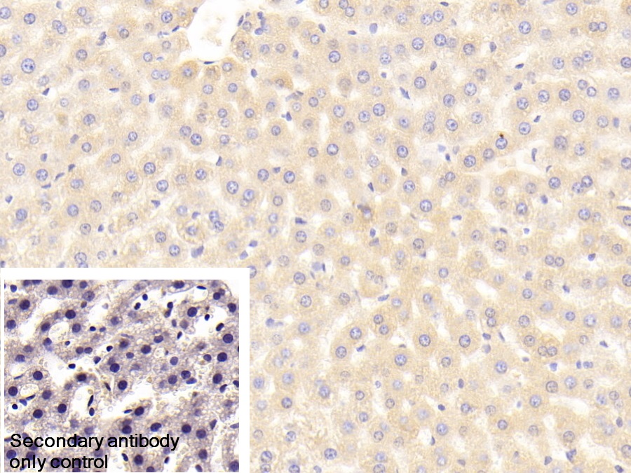 Polyclonal Antibody to Transferrin (TF)