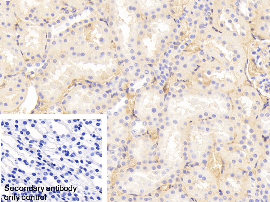 Polyclonal Antibody to Transferrin (TF)