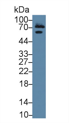 Polyclonal Antibody to Transferrin (TF)