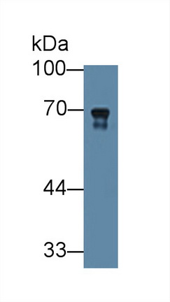 Polyclonal Antibody to Transferrin (TF)