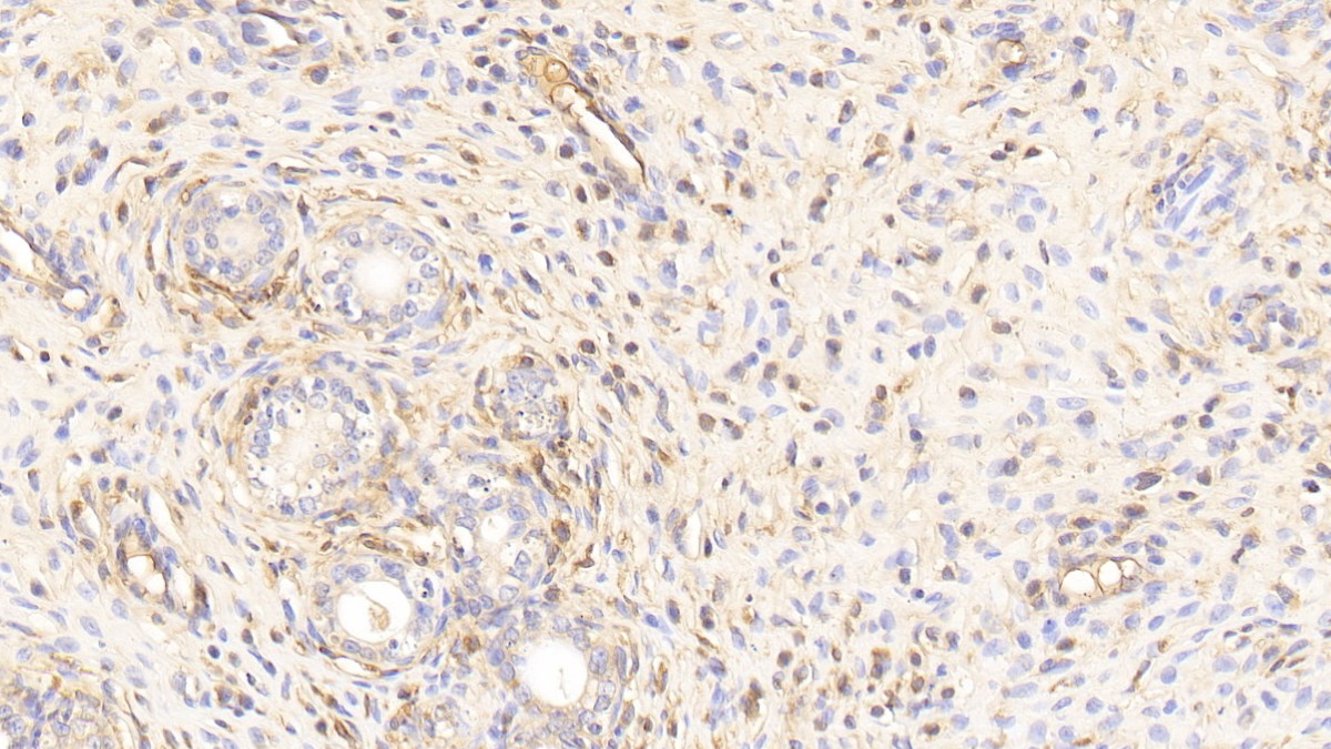 Polyclonal Antibody to Transferrin (TF)