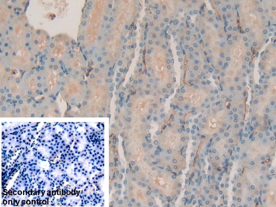 Polyclonal Antibody to Transferrin (TF)