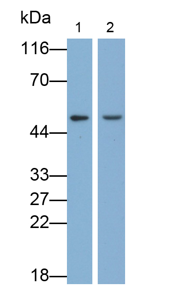 Polyclonal Antibody to Farnesoid X Receptor (FXR)