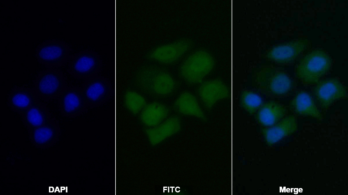 Polyclonal Antibody to Survivin (Surv)