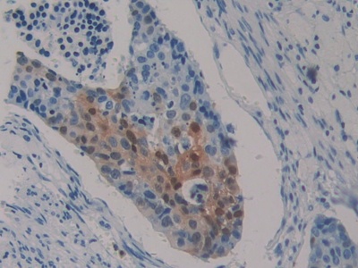 Polyclonal Antibody to S100 Calcium Binding Protein P (S100P)