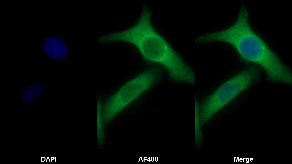 Polyclonal Antibody to S100 Calcium Binding Protein P (S100P)