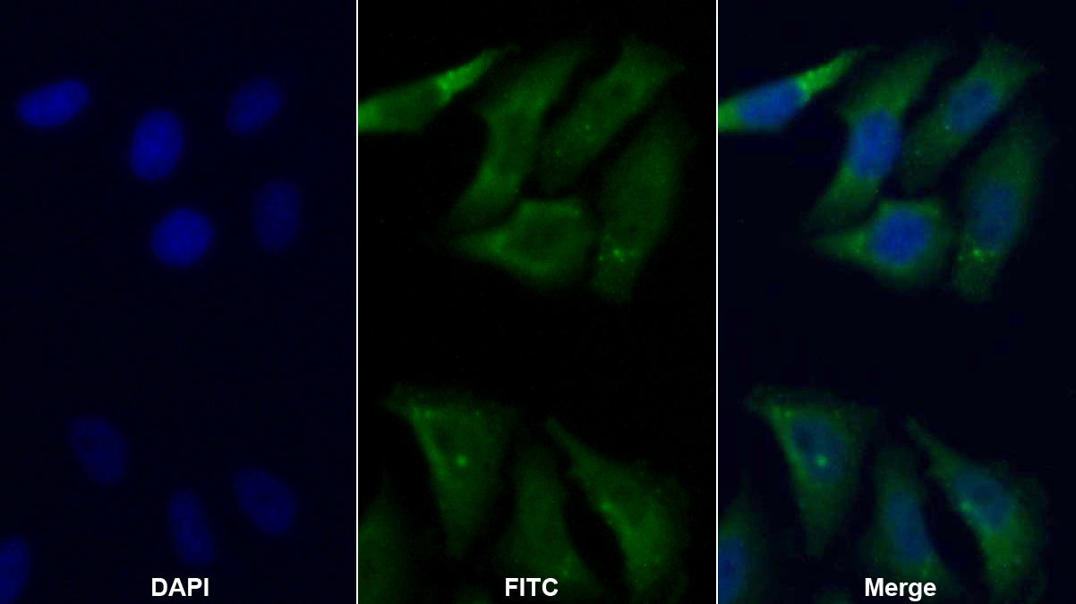 Polyclonal Antibody to Matrix Metalloproteinase 14 (MMP14)
