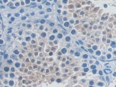 Polyclonal Antibody to Receptor Activator Of Nuclear Factor Kappa B (RANk)