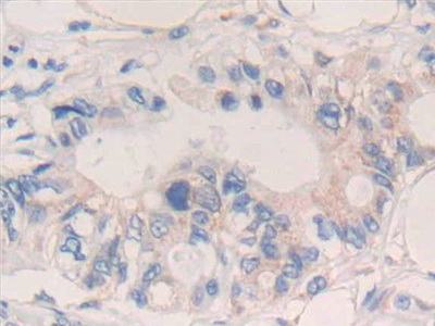 Polyclonal Antibody to Interleukin 20 (IL20)