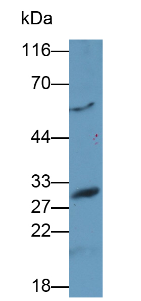 Polyclonal Antibody to Asialoglycoprotein Receptor 2 (ASGR2)
