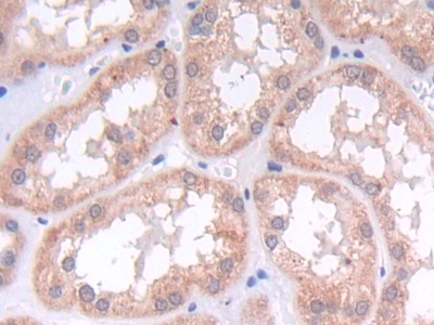 Polyclonal Antibody to Laminin Beta 2 (LAMb2)