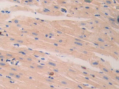 Polyclonal Antibody to Laminin Beta 2 (LAMb2)