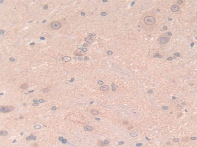 Polyclonal Antibody to Laminin Beta 2 (LAMb2)