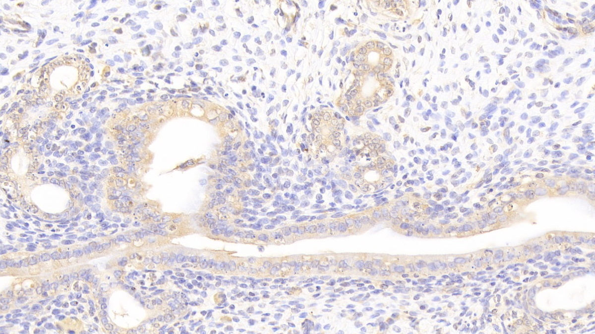 Polyclonal Antibody to Laminin Beta 2 (LAMb2)