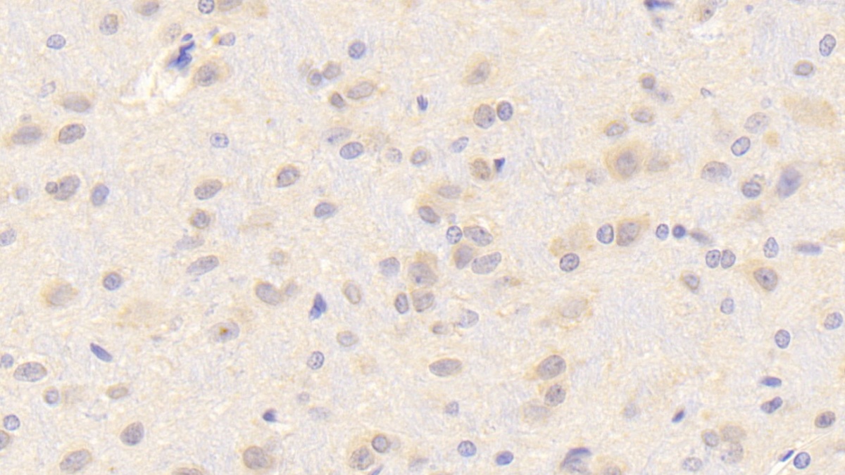 Polyclonal Antibody to Laminin Beta 2 (LAMb2)