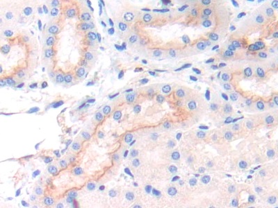 Polyclonal Antibody to Integrin Alpha 9 (ITGa9)