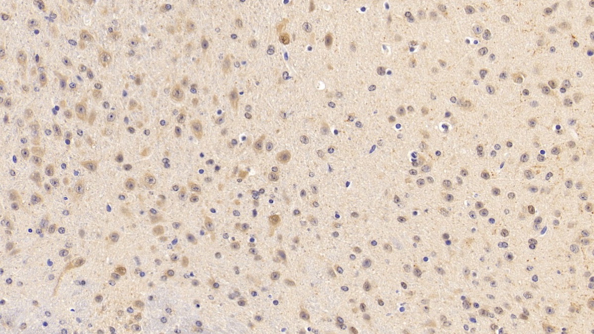 Polyclonal Antibody to Activin A Receptor Type I B (ACVR1B)