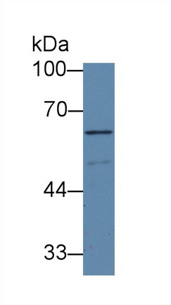 Polyclonal Antibody to Activin A Receptor Type I C (ACVR1C)