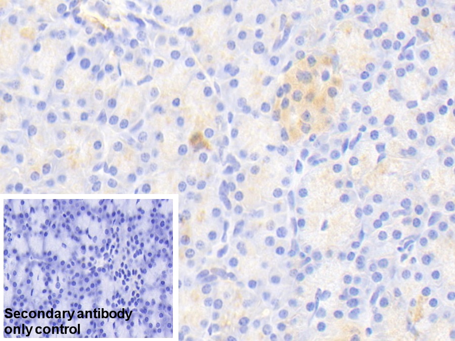 Polyclonal Antibody to Activin A Receptor Type I C (ACVR1C)