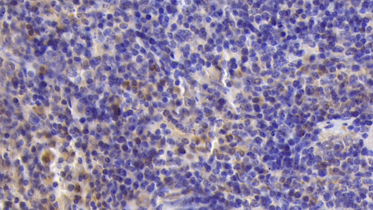 Polyclonal Antibody to Activin A Receptor Type II A (ACVR2A)