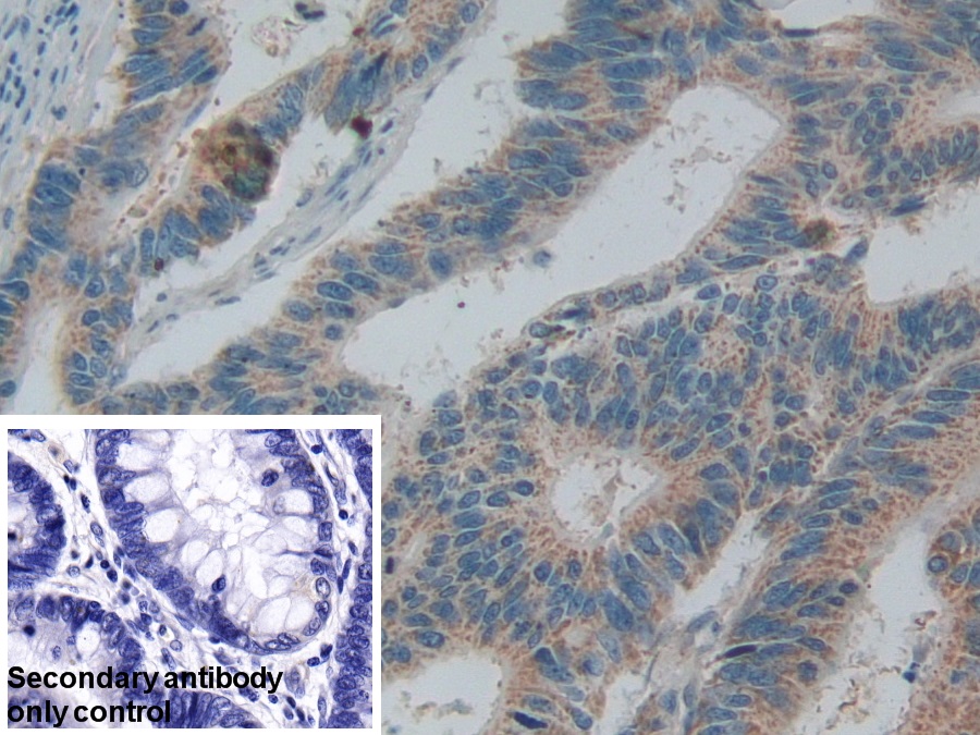 Polyclonal Antibody to SMAD family member 5 (SMAD5)