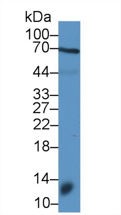 Polyclonal Antibody to Decorin (DCN)