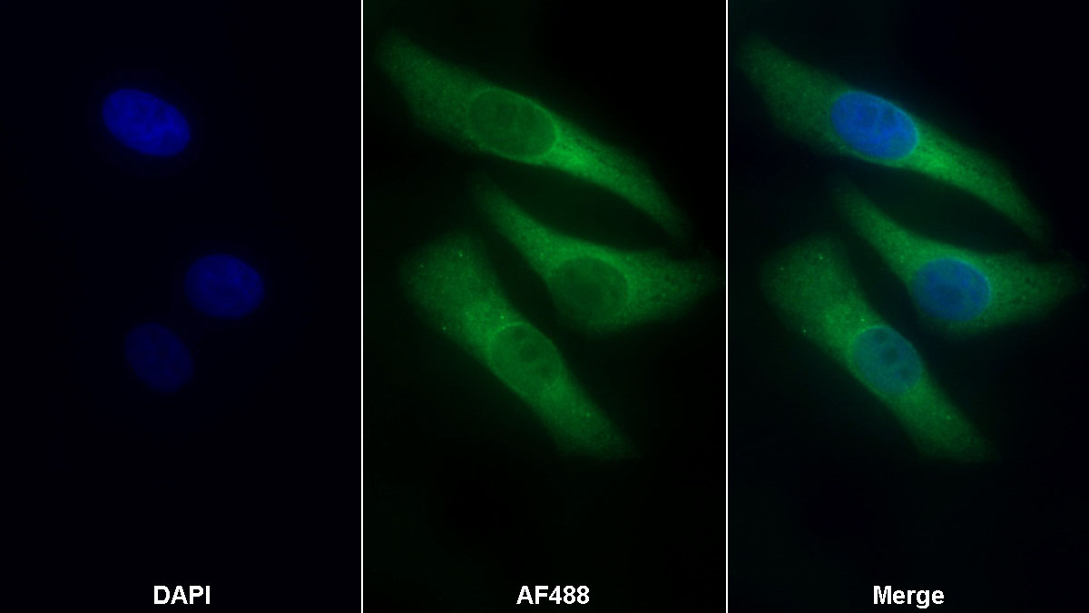 Polyclonal Antibody to Collagen Type IV Alpha 4 (COL4a4)