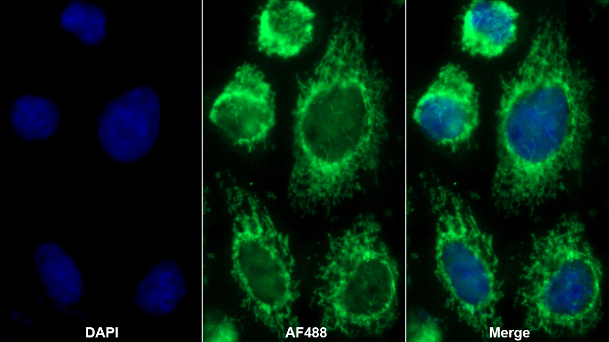 Polyclonal Antibody to Collagen Type IV Alpha 3 (COL4a3)
