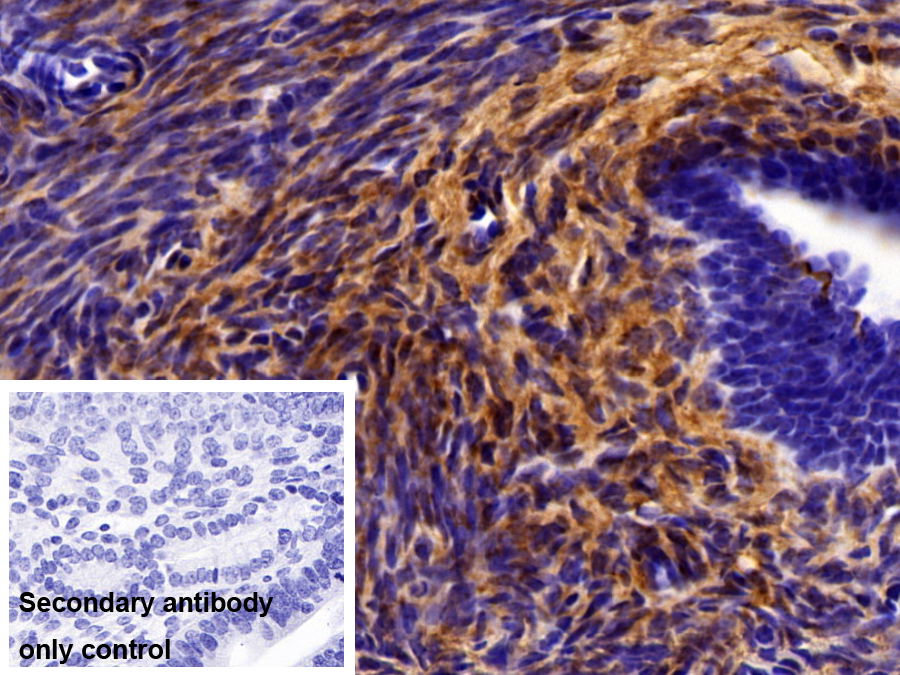 Polyclonal Antibody to Collagen Type VI Alpha 1 (COL6a1)