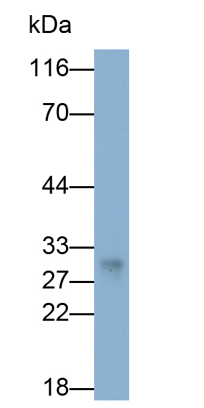 Polyclonal Antibody to HLA Class II Histocompatibility Antigen, DR Alpha Chain (HLA-DRA)