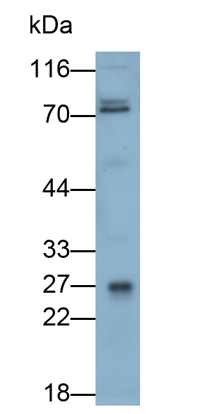 Polyclonal Antibody to HLA Class II Histocompatibility Antigen, DR Alpha Chain (HLA-DRA)