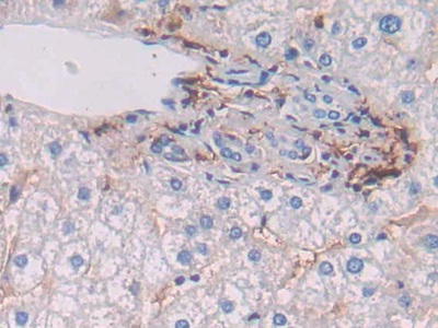 Polyclonal Antibody to HLA Class II Histocompatibility Antigen, DRB1 Beta Chain (HLA-DRB1)