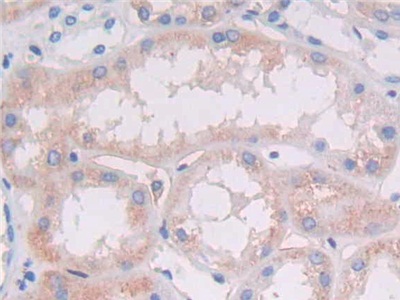 Polyclonal Antibody to HLA Class II Histocompatibility Antigen, DRB1 Beta Chain (HLA-DRB1)