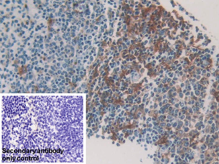 Polyclonal Antibody to HLA Class II Histocompatibility Antigen, DRB1 Beta Chain (HLA-DRB1)