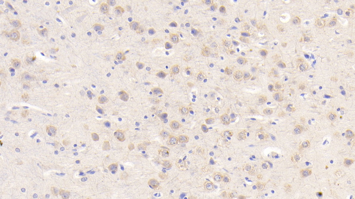 Polyclonal Antibody to Glial Cell Line Derived Neurotrophic Factor Receptor Alpha 2 (GFRa2)