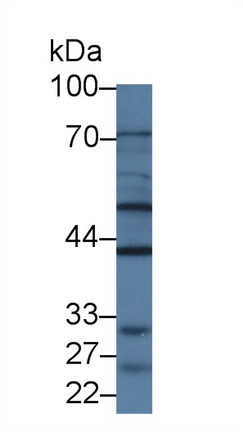 Polyclonal Antibody to Glial Cell Line Derived Neurotrophic Factor Receptor Alpha 2 (GFRa2)